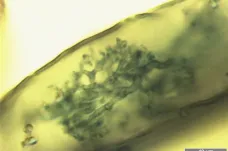 Půdní houby pomáhají rostlinám přijímat fosfor. Tuto symbiózu ale ničí pesticidy
